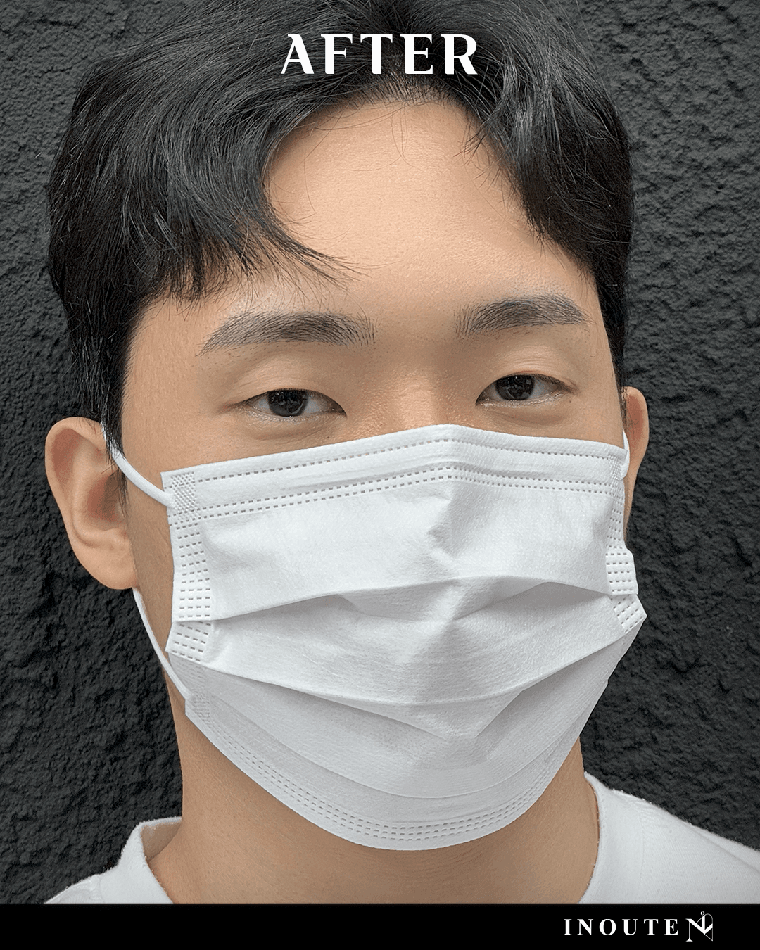 브로우 컨설팅(B/A)