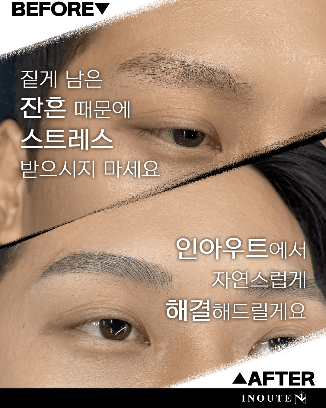 잔흔 커버(초록색 잔흔)