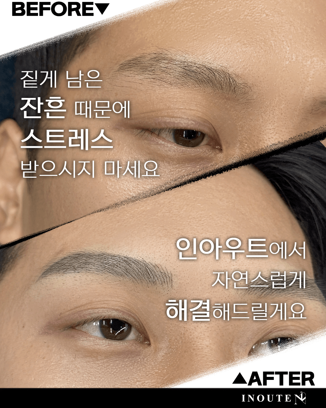 잔흔 커버(초록색 잔흔)