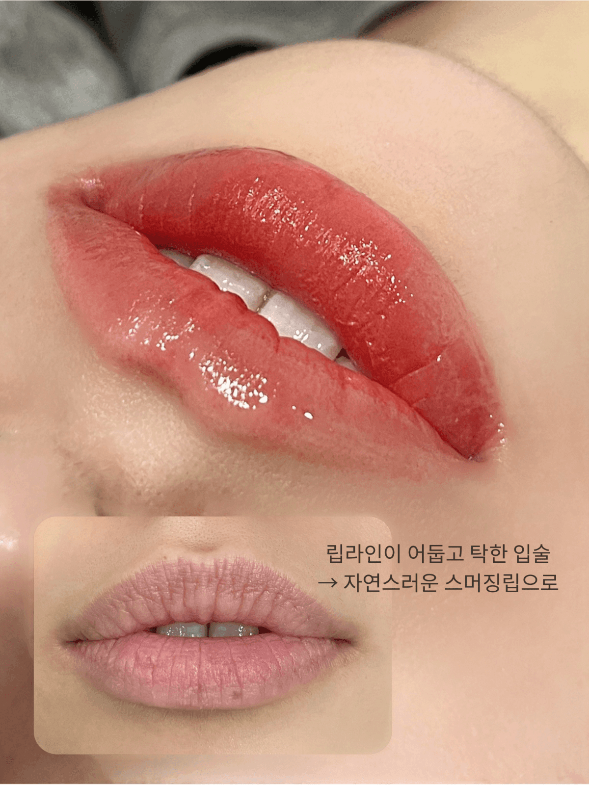 스머징립