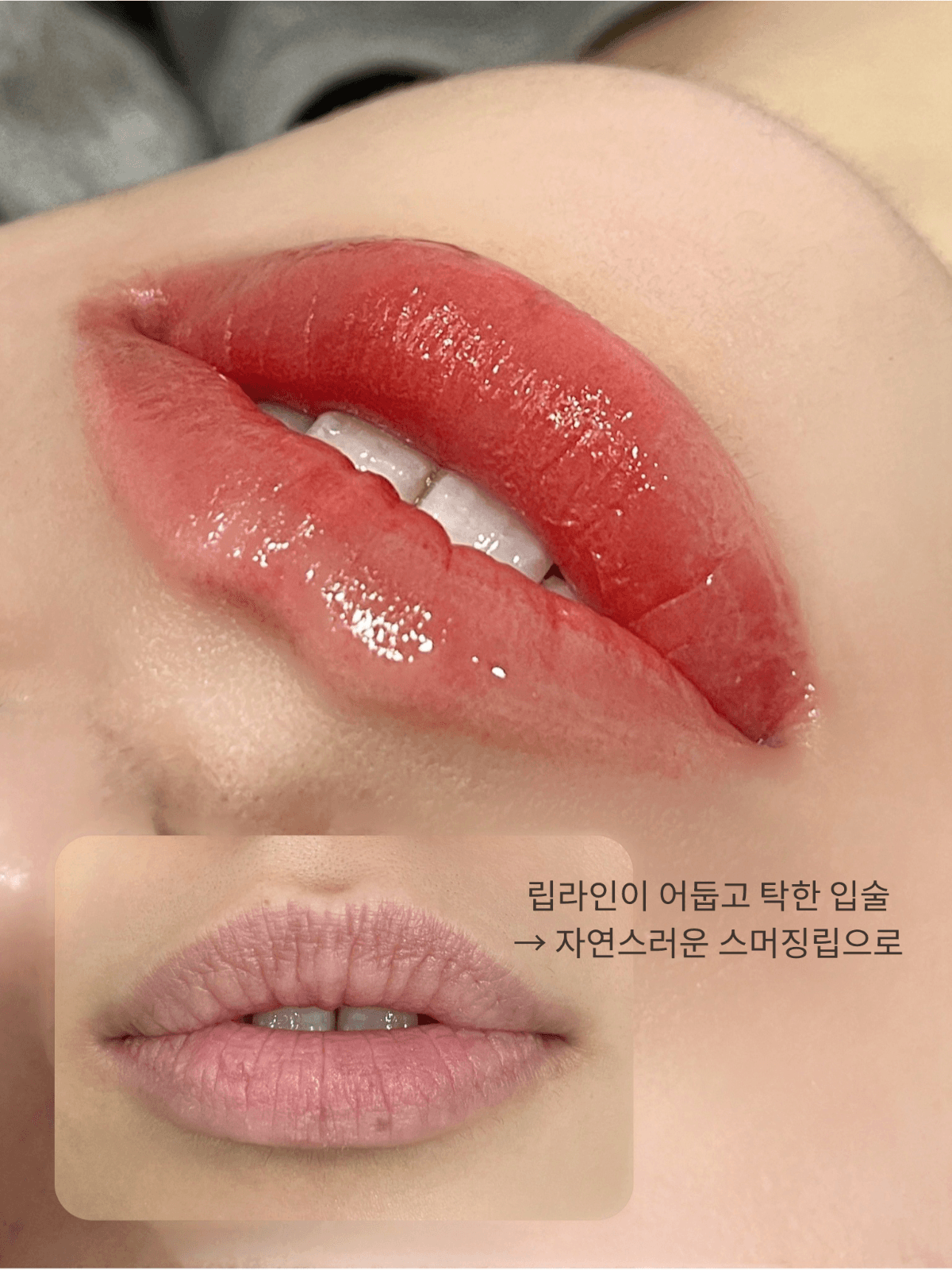 스머징립
