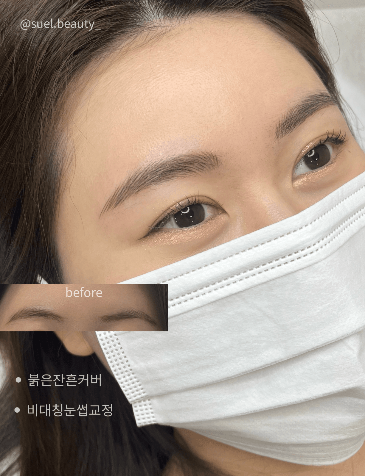 🤍자연결 눈썹|비대칭 교정 & 붉은 잔흔 커버 오픈이벤트🤍