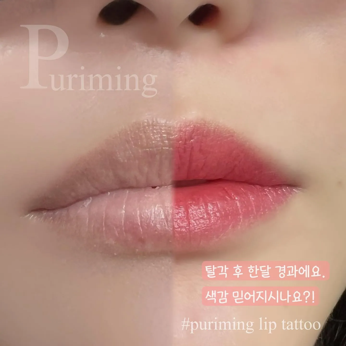입술문신 하시기전에!! 탈각 후 사진이 있는지 꼭 확인하세요:) 사진 속 고객님은 탈각 후 한달 경과인데 색감 보이시나요?!✌️🥰