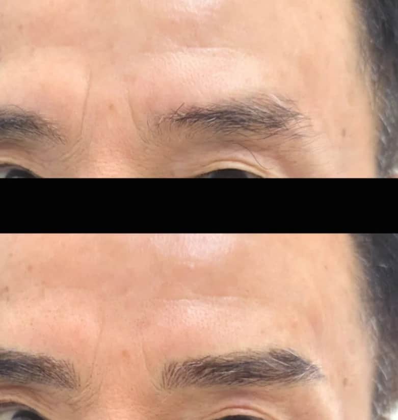 부분 눈썹