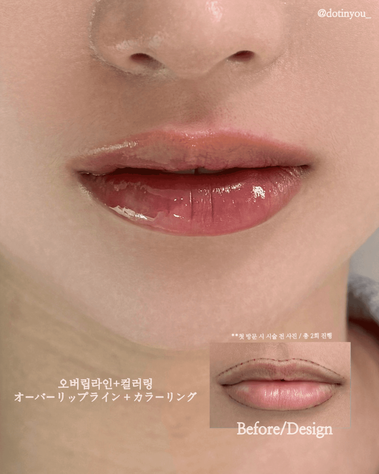입술 립라인+컬러링(오버립/틴트립)