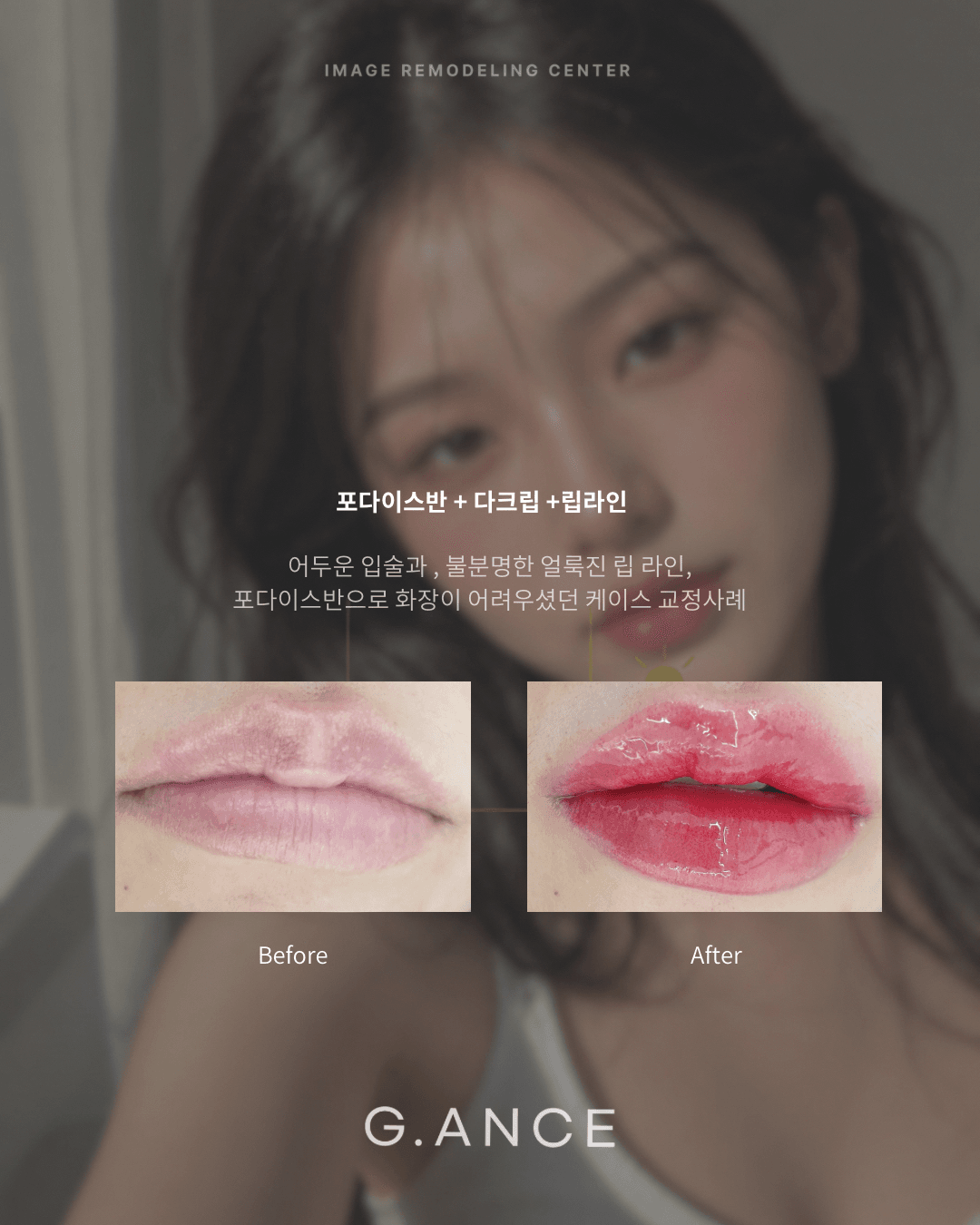 틴트입술