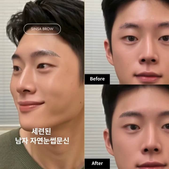 자연눈썹복원시술