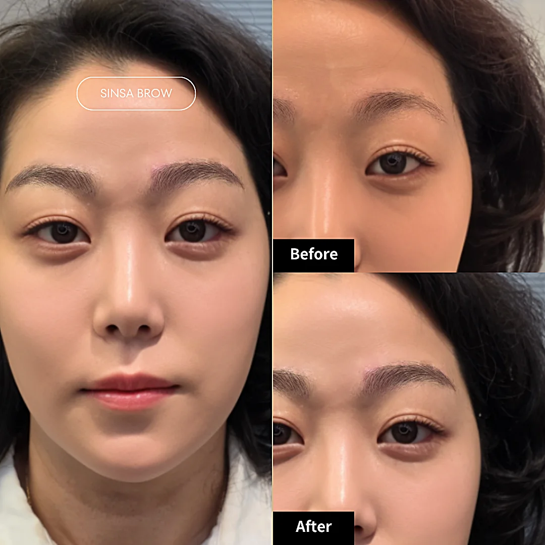 여성 자연눈썹복원
