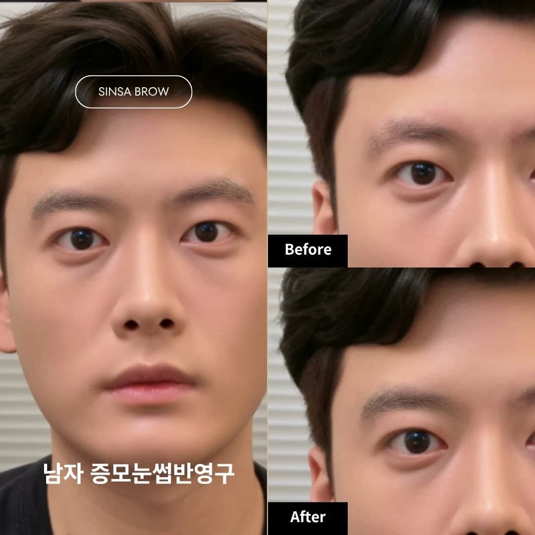 남자 증모눈썹 반영구