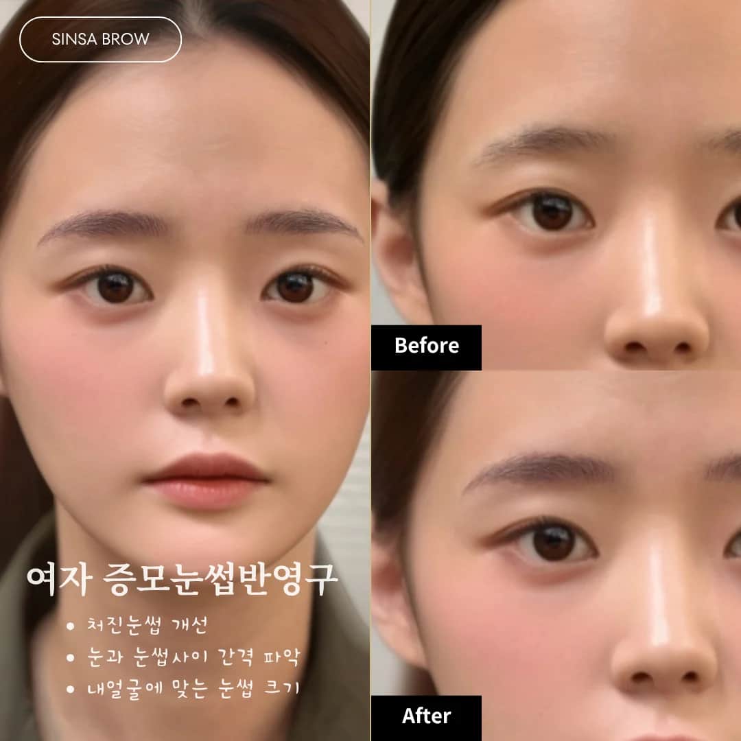 여자 증모눈썹 반영구