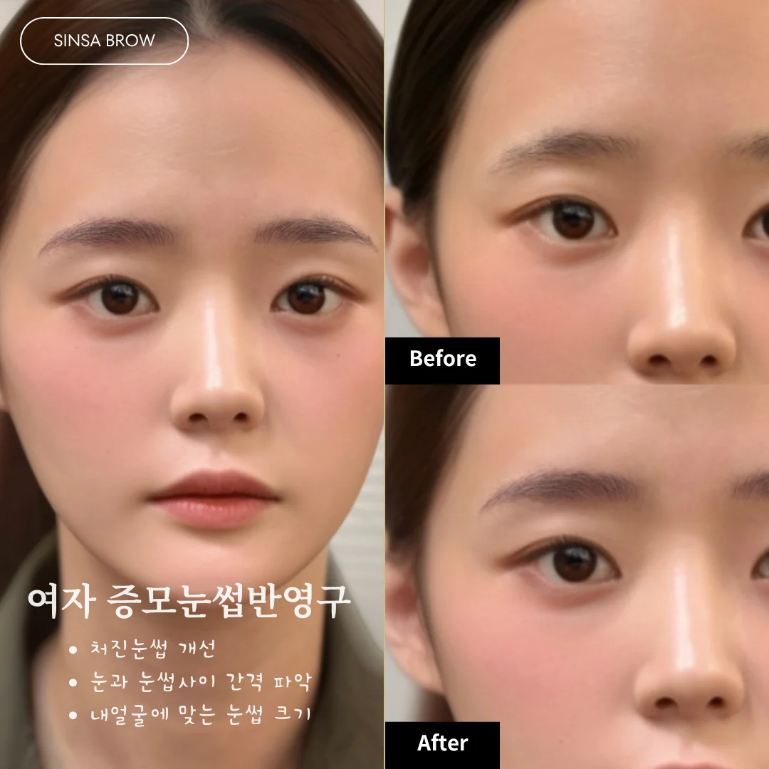 여자 증모눈썹 반영구