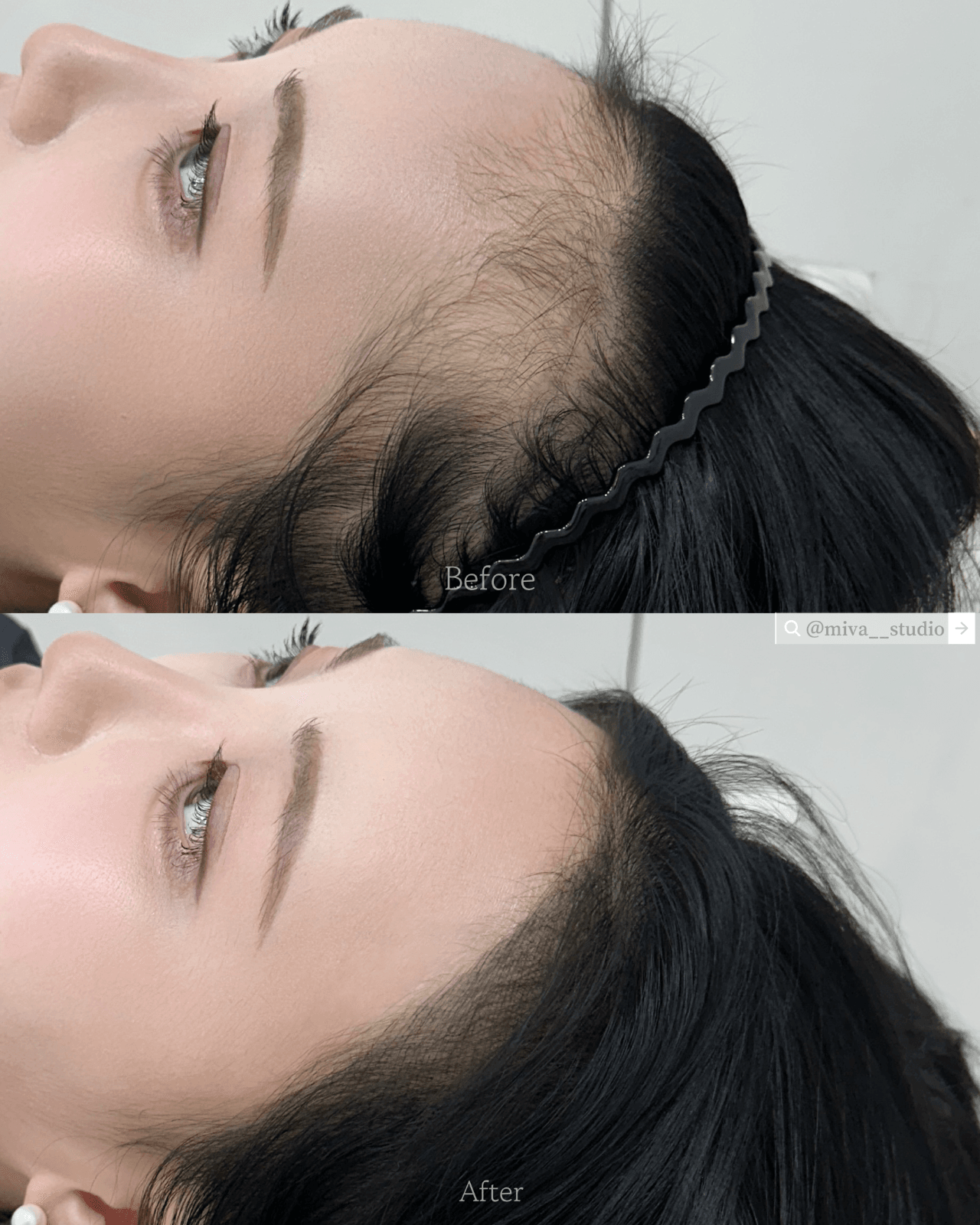 둥근이마 헤어라인🖤