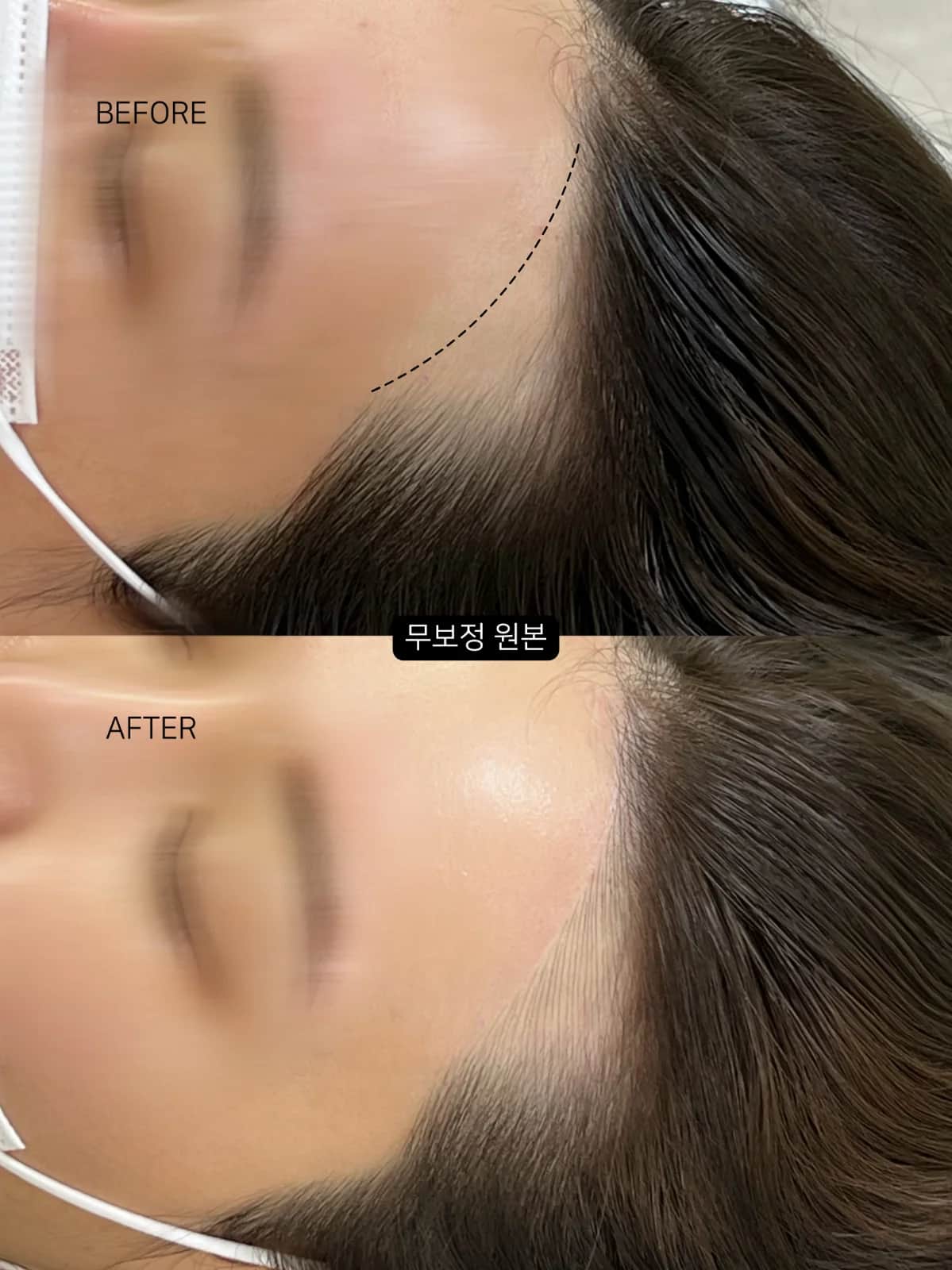 용산 헤어라인