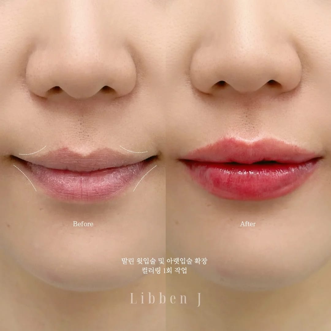 오버립+컬러