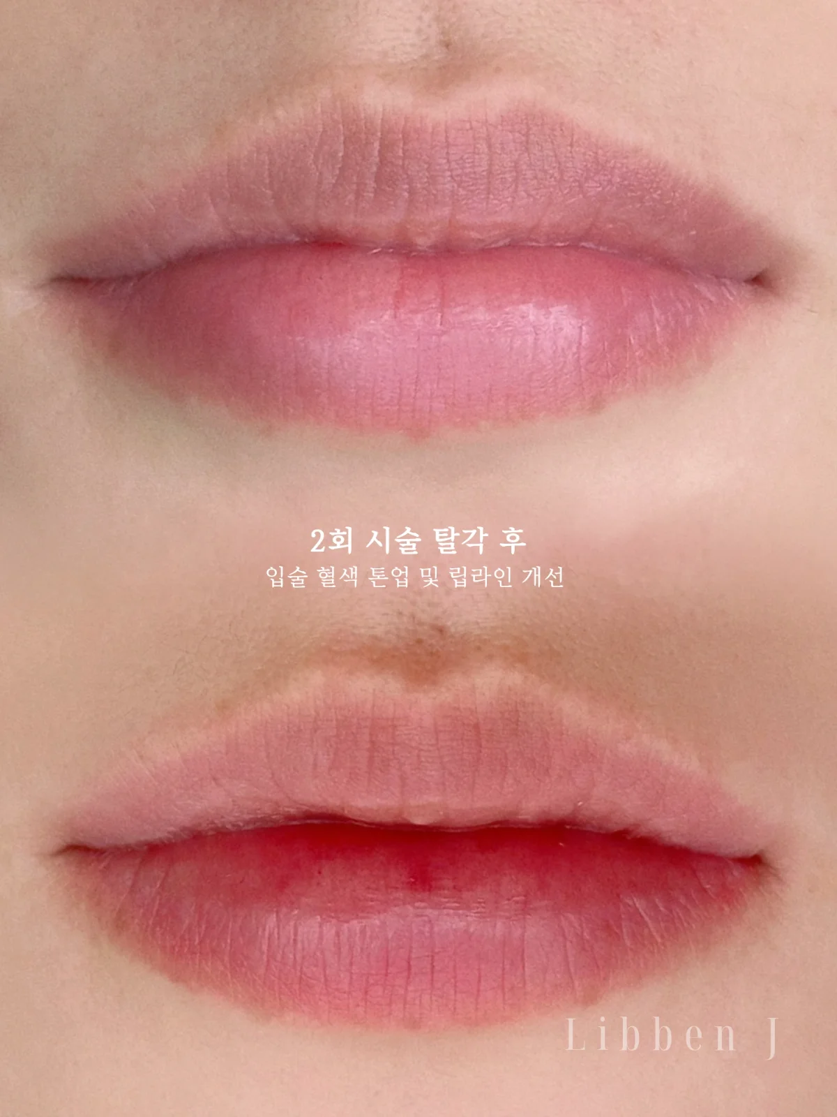 오버립+그라데이션 탈각후